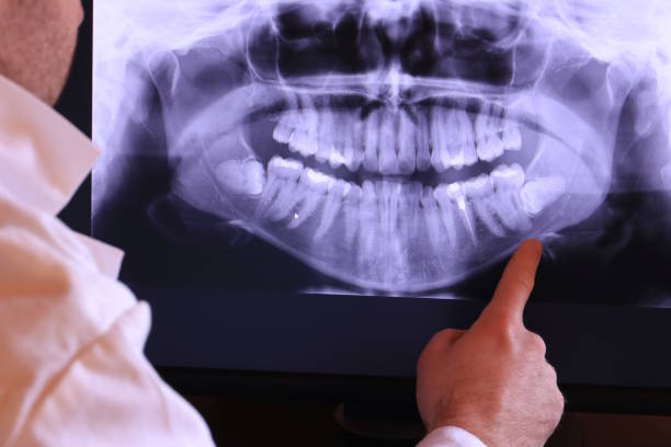 Best Urgent Care for Lost Fillings or Crowns in Bunk Foss, WA