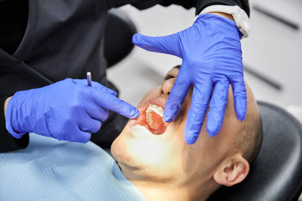 Best Emergency Gum Treatment in Bunk Foss, WA