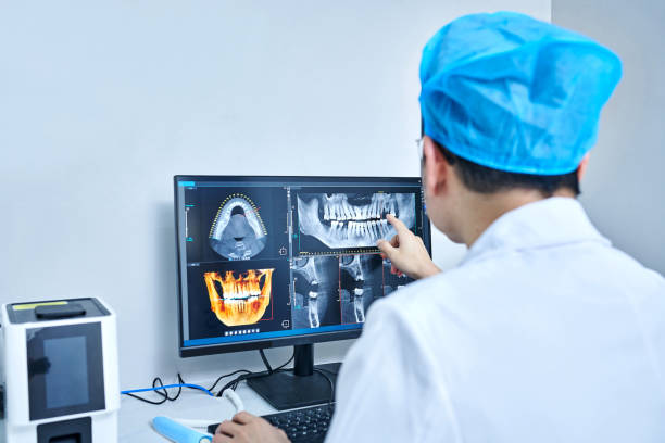 Best Emergency Wisdom Teeth Removal in Bunk Foss, WA